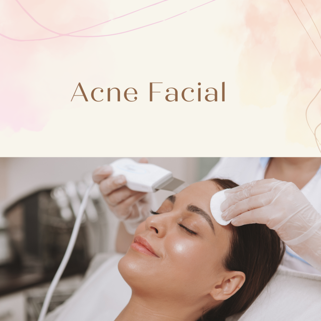 Full-Facial-acne