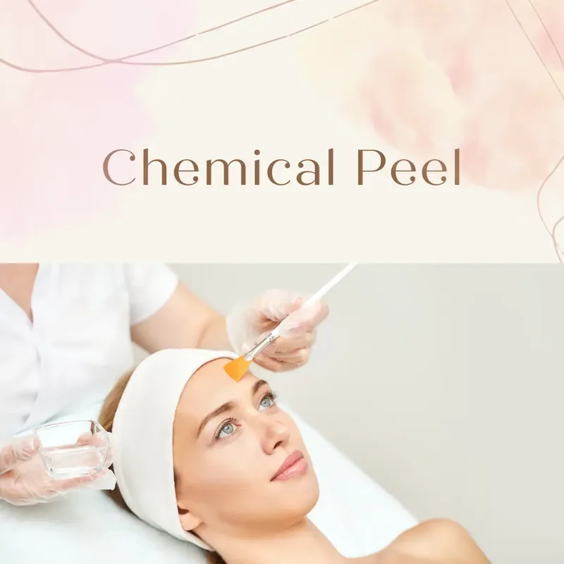 Chemical peel skin treatment at SKINON in Hamilton, Ontario